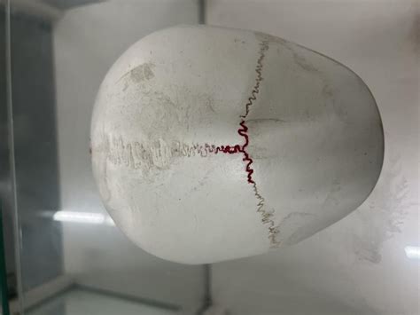 Calvaria Bones WITH SUTURES | NAMO Medical Education & Research Institute