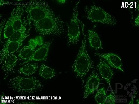 Image result for Ana Pattern Screen