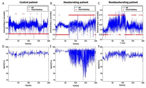 Combining Heart Rate Variability and Oximetry to Improve Apneic Event ...