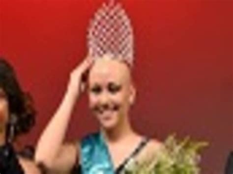 Brave, bald and beautiful - girl ditches wig and wins pageant!