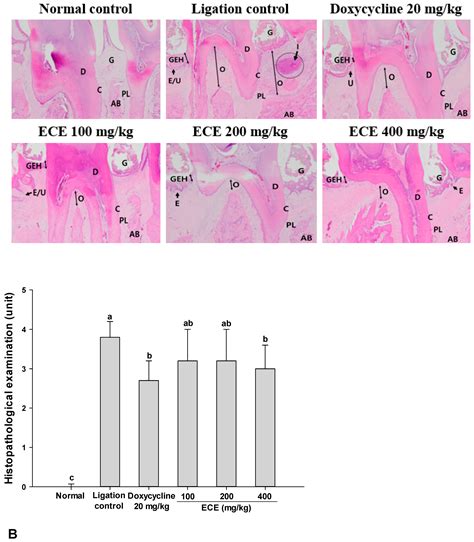 Anti-Inflammatory Effect of Ecklonia cava Extract on Porphyromonas ...