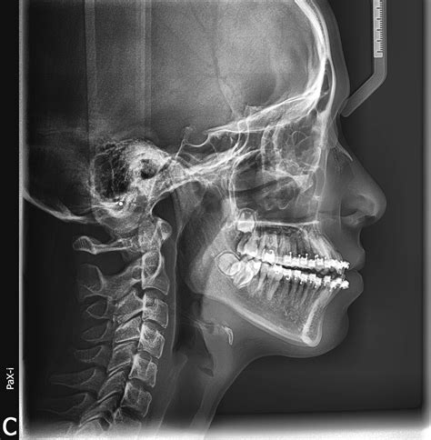 Advantages of Digital Radiology: Enero 2016