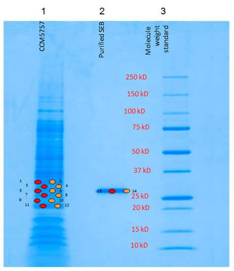 Intact Staphylococcus Enterotoxin SEB from Culture Supernatant Detected ...