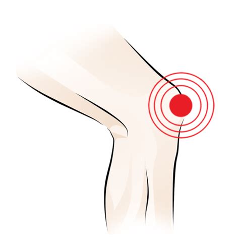 Buy Orthotics for Knee Pain Online in India | Knee Pain Insoles