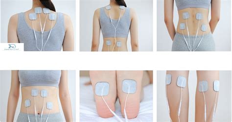 Using a Tens Unit 的图像结果