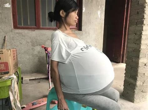 “我怀孕了，胎儿40斤”：被忽略的最凶妇癌，每年毁掉2.5万女人_腾讯新闻