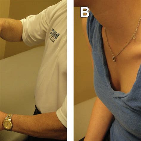 Image result for Sulcus Sign Shoulder