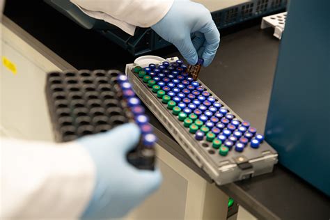 必应检验科 的图像结果