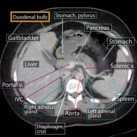 Gross Anatomy Glossary: Small Intestine - Duodenum Imaging | ditki medical & biological sciences