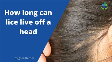 Can Bleaching Hair Kill Lice