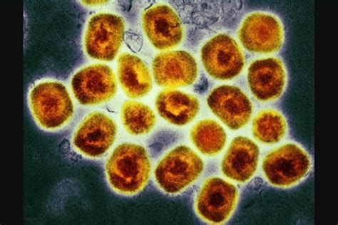 研究人员发现猴痘病毒正突变 影响暂未可知_环科频道_财新网