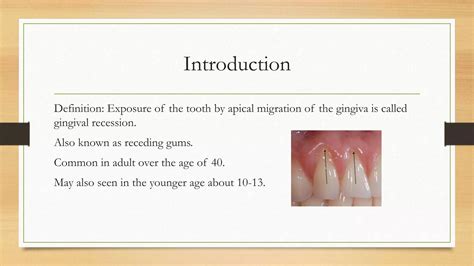 Gingival Recession, Gums Recession, | PPTX