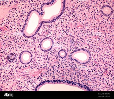 Proliferative phase hi-res stock photography and images - Alamy