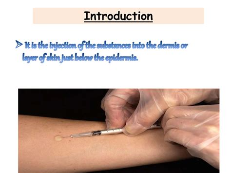 Injection Types 的图像结果