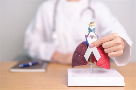 Síntomas iniciales del cáncer de pulmón: mejora el diagnóstico