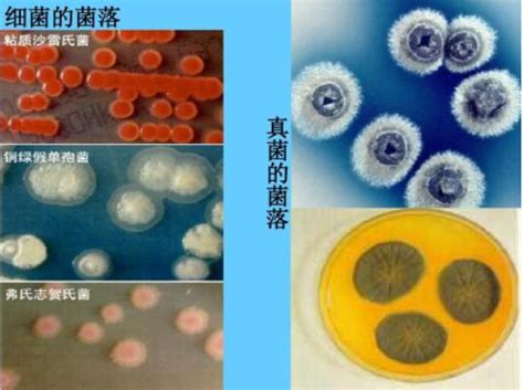 芽殖酵母细胞与假菌丝照片摄影图片_ID:125421137-Veer图库