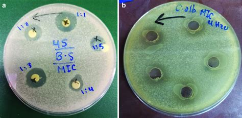 Image result for Mic Disc Diffusion Method