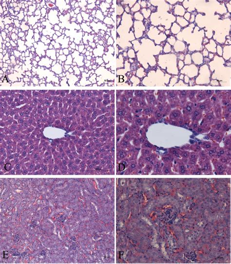 Analysis of the Toxicity and Histopathology Induced by the Oral ...