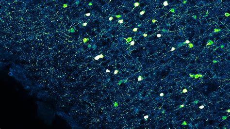 Brain Science.com 的图像结果