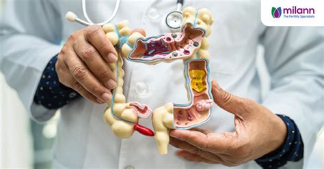 Milann | The Fertility Specialist