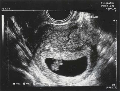 Types and Uses of Ultrasounds