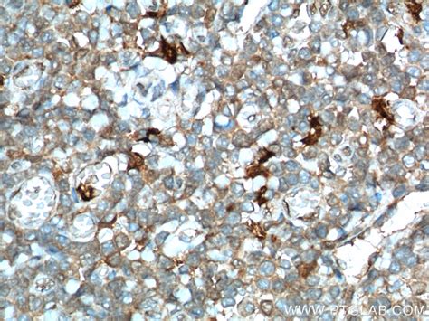 IDO1 antibody (13268-1-AP) | Proteintech