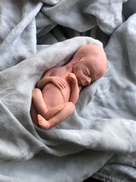 Why Does A Stillborn Baby Look Like That at Melissa Trexler blog