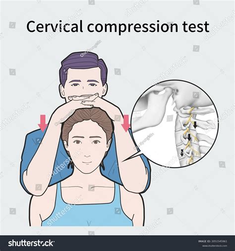 Image result for Max Cervical Compression Test