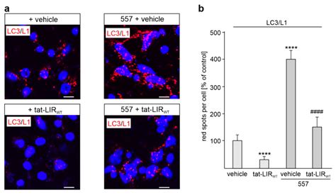 Interaction of L1CAM with LC3 Is Required for L1-Dependent Neurite ...