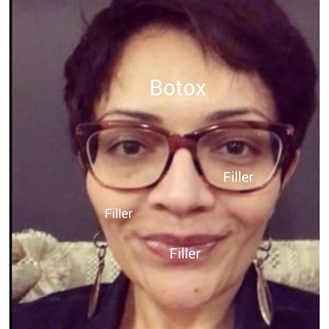 I lost 55kgs but I continued to struggle with dysmorphia – Essential ...