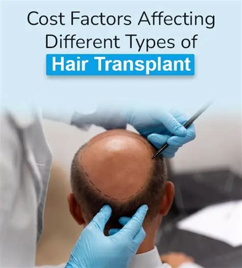 Hair Transplant Cost in Delhi NCR (2025) | ₹45K–₹2.5L Price & Offers