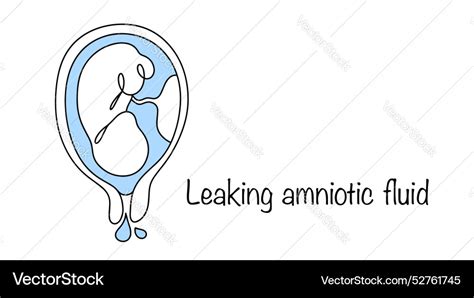 Leaking amniotic fluid Royalty Free Vector Image