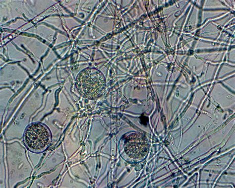 TNAU Agritech Portal :: Crop Protection