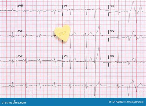 Abnormal Electrocardiogram