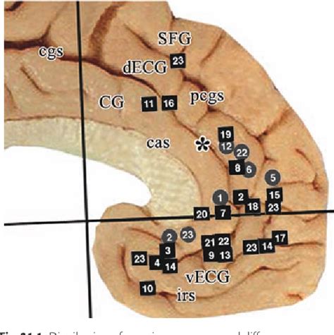 Cingulate cortex Disorders 的图像结果