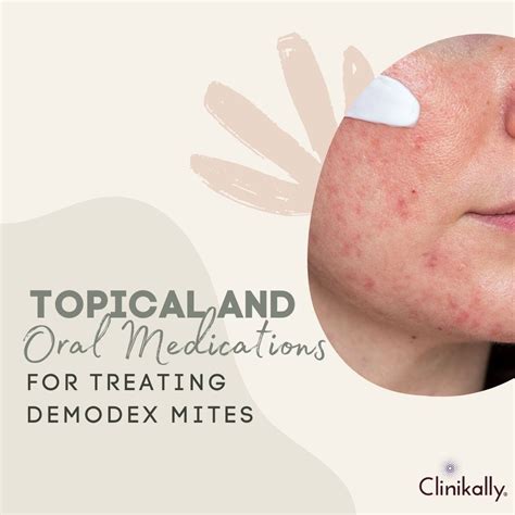 Demodex Mites and Rosacea: Connection and How to Treat It | Clinikally
