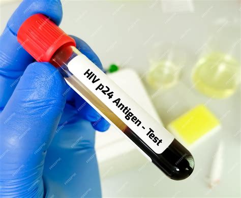 Prueba del antígeno p24 del vih para el diagnóstico precoz de la ...