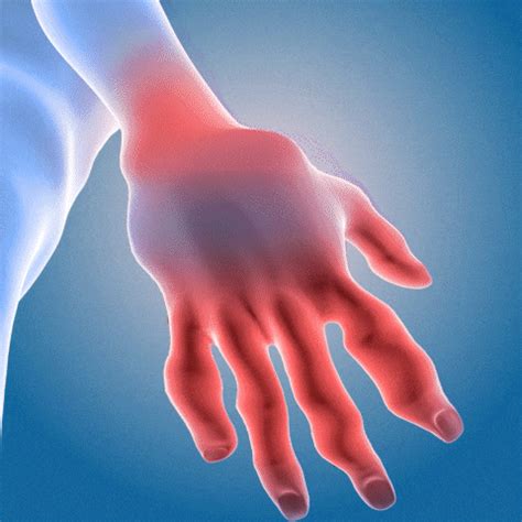 Perfectx Joint and Bone Treatment Cream (Buy 1 Get 1 Free) – Net Value