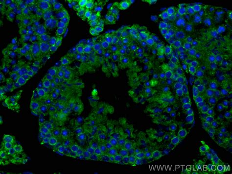 RXFP1 antibody (18419-1-AP) | Proteintech