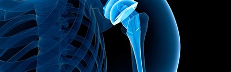 Arthroscopic Treatment for Weight Lifters in South Delhi