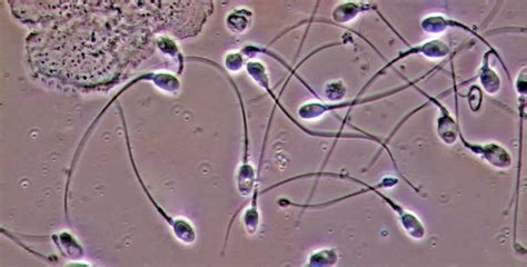 वायुप्रदूषणाचा वीर्य गुणवत्तेवर होतो परिणाम, नवीन अभ्यासाने केले सूचित ...