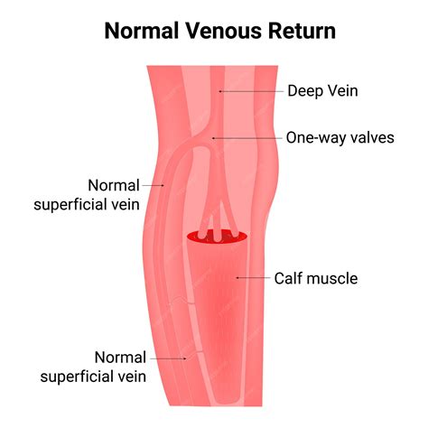 Premium Vector | Normal venous return deep vein oneway valves calf ...