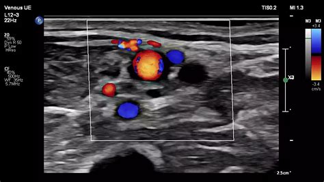 Philips Affiniti 50 ultrasound machine