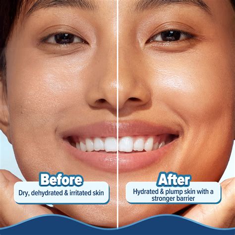 5 Barrier+ Hydra Gel Moisturizer with Avocado & 5 Essential Ceramides ...