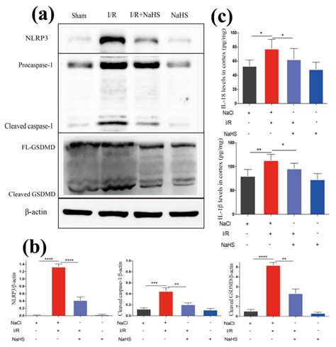 Hydrogen Sulfide Attenuates Neuroinflammation by Inhibiting the NLRP3 ...