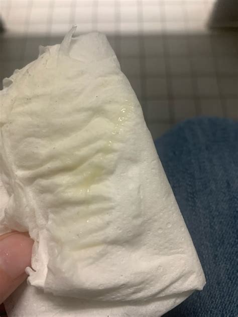 Yellowish Greenish discharge?? TMI photo - Glow Community