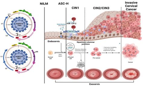FAM19A4 and hsa-miR124-2 Double Methylation as Screening for ASC-H- and ...