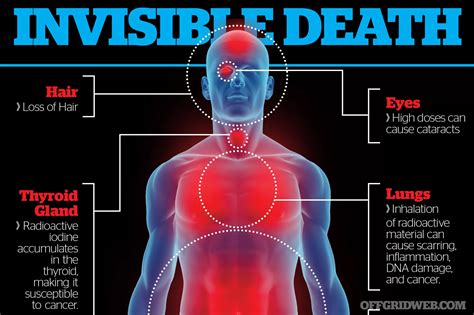 What Are The Effects Of X Ray Radiation at Kevin Davidson blog