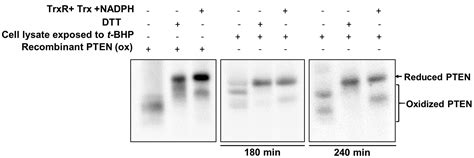 Redox Regulation of the Tumor Suppressor PTEN by Hydrogen Peroxide and ...
