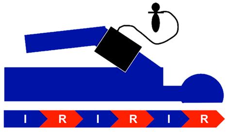 Remote Ischemic Preconditioning Neither Improves Survival nor Reduces ...